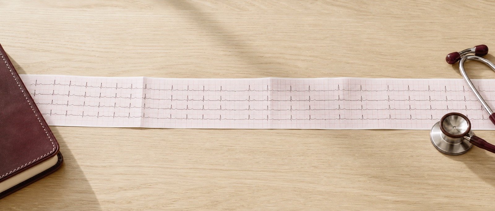 Tracé d’électrocardiogramme imprimé sur papier millimétré, posé sur un bureau avec un stéthoscope